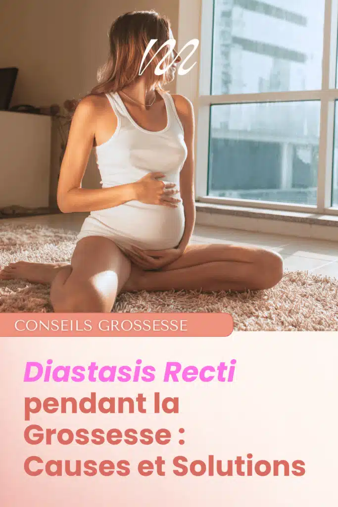 diastasis recti